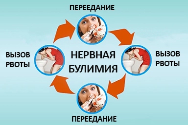 Лечение булимии в Котово